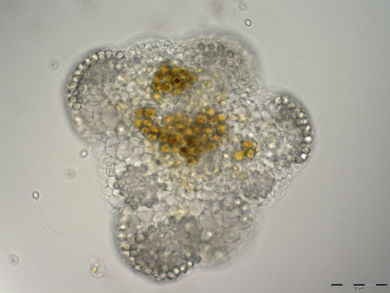 Cassiosome_bf_5July18-021_Under Compound Scope.tif